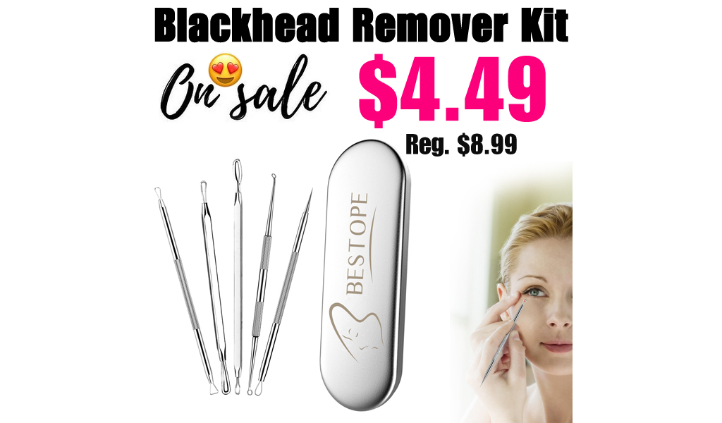 Blackhead Remover Kit Only $4.49 Shipped on Amazon (Regularly $8.99)